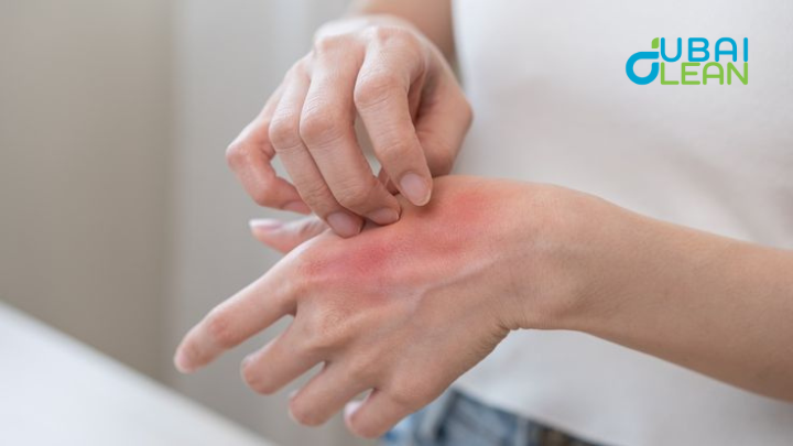 Pest-Related Itchy Skin Reactions 